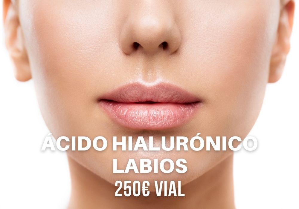 oferta acido hialuronico labios en gandia